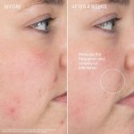 Augustinus Bader Cleansing Balm & Foaming Cleanser review